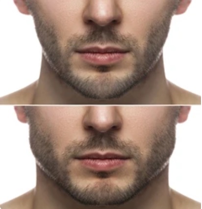 Facial Transformation Man